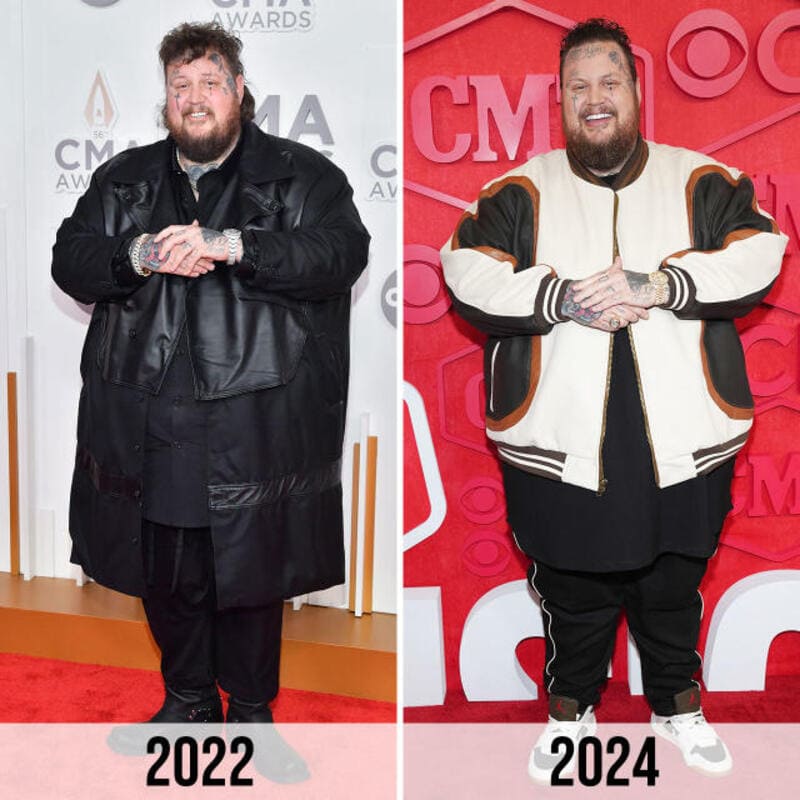 Jelly Roll Before and After Weight Loss